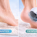 Eliminador de callos