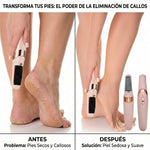 Eliminador De Callos